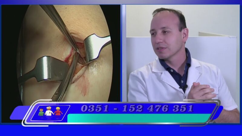 Novedosa técnica quirúrgica para la reparación de hernias