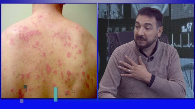 Diagnósticos diferenciales en dermatología
