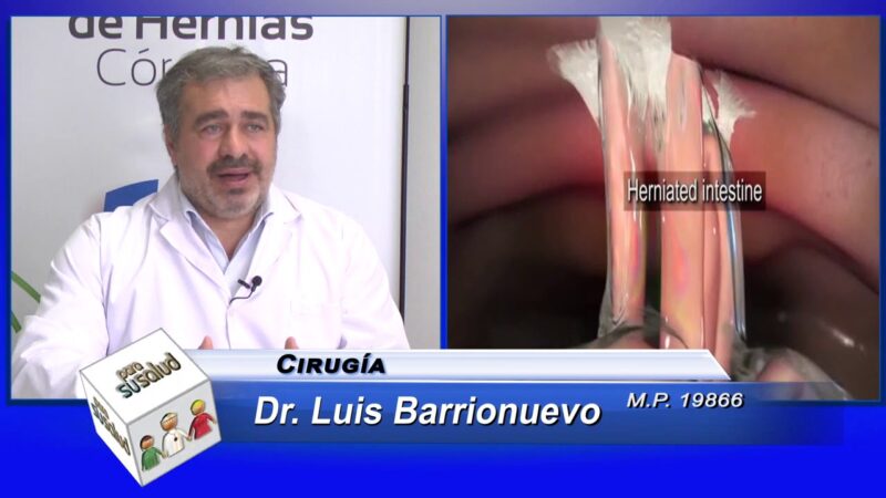 Â¿Carece de riesgo la cirugÃ­a de hernias?