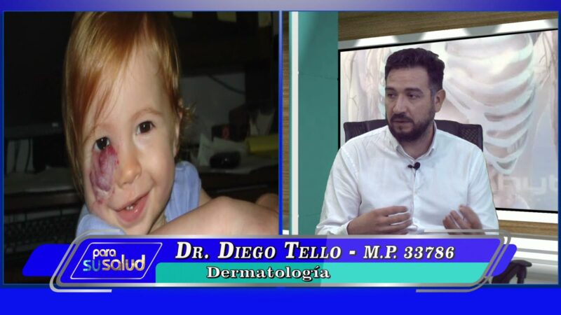 Angiomas ¿se puede borrar con injerto de piel?
