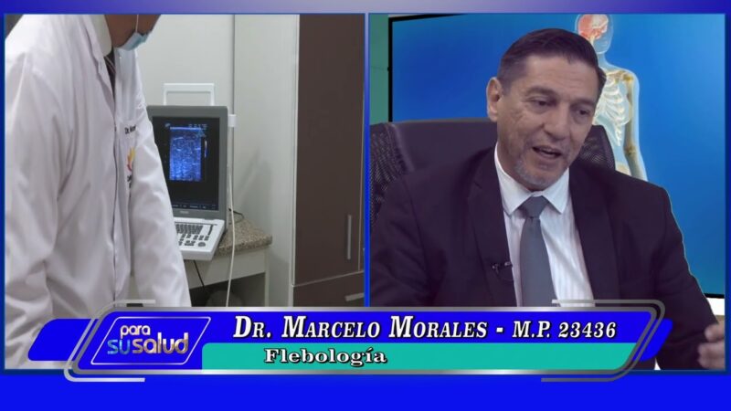 A que edad aparecen las varices