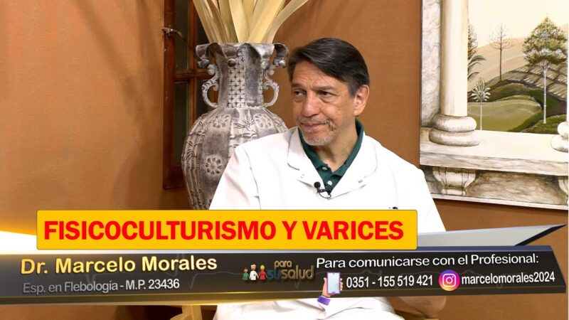¿Los fisicoculturistas tienen mas varices?
