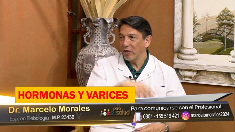 Cambios hormonales provocan varices