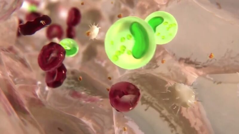 Cirugía videolaparoscópica de tiroides y glándulas suprarrenales