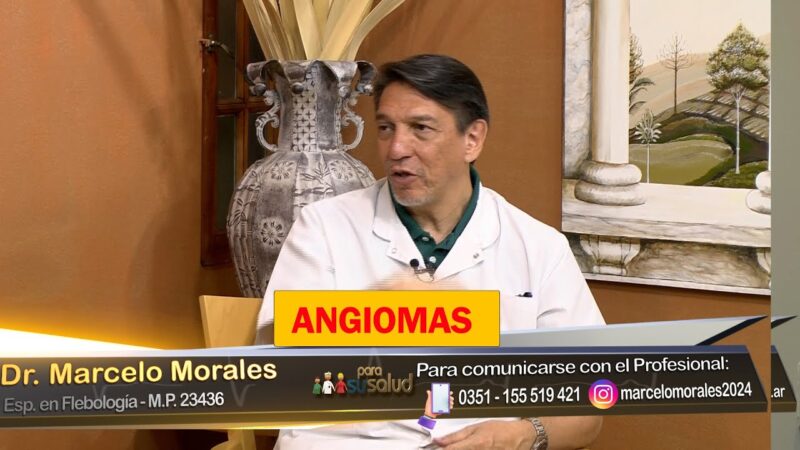 Angiomas ¿Es posible corregirlos?