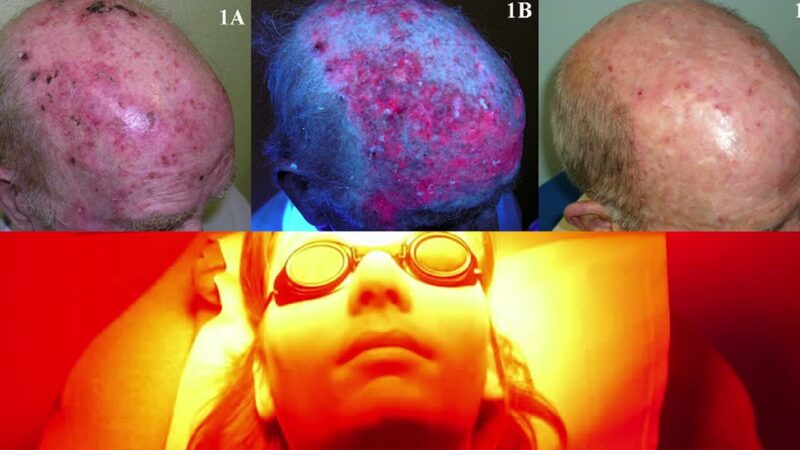 Avances tecnológicos en dermatología ¿Estamos en condiciones económicas de incorporarlos?