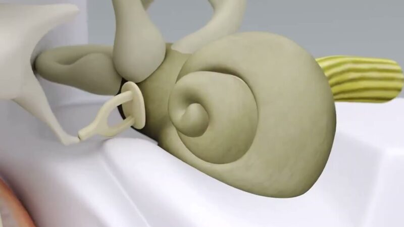 Vértigos benignos ¿Existen?