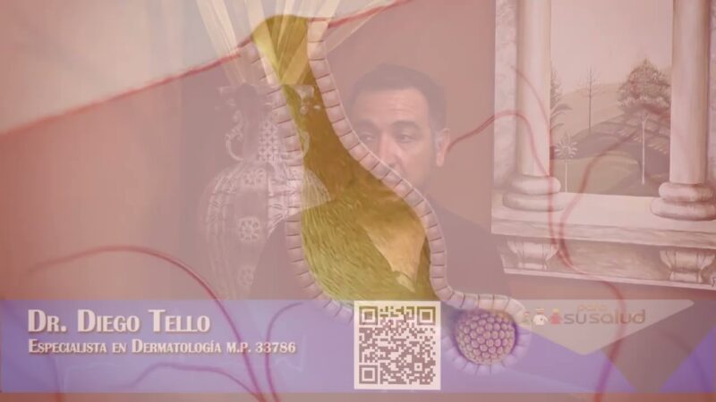 ¿Siempre el chocolate y la menstruación provocan acné?