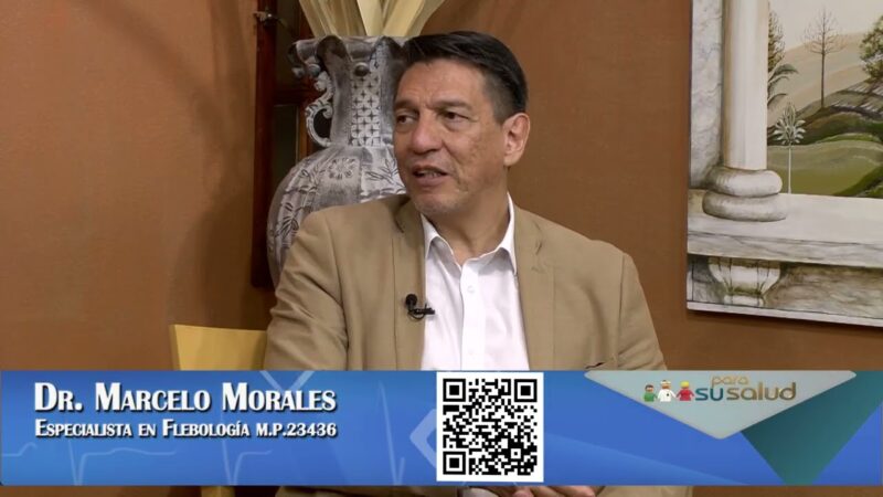 Cuál es el mejor tratamiento para mis varices