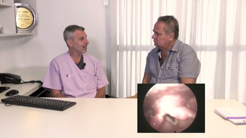 Estudios para conocer objetivamente la presencia de Apnea del sueño