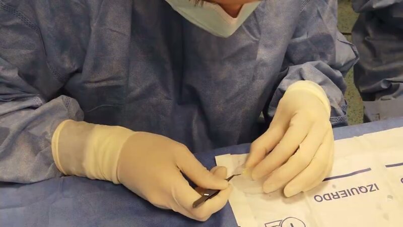 Cataratas: ¿En alguna persona está contraindicada la cirugía?